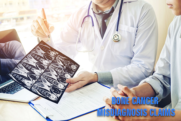Bone Cancer Misdiagnosis Claims