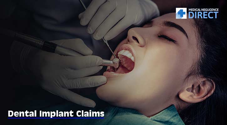 dental implant claims