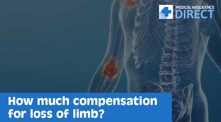 Compensation for Loss of Limb