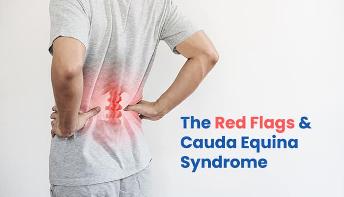 Cauda Equina Syndrome Red Flags